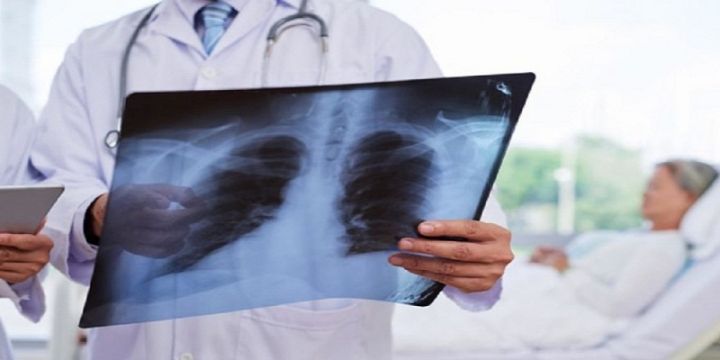 В Свердловске стали меньше болеть пневмонией