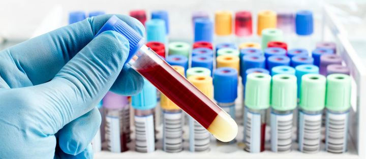 Не блещут умом: учёные выяснили, обладатели какой группы крови самые глупые