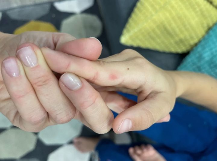 Эпидемиолог призвал жителей России не ездить на курорты в Турцию: там выявили опасный вирус