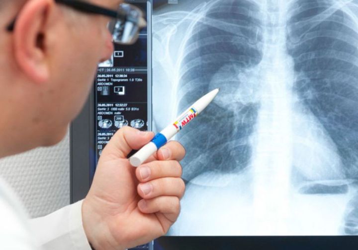 Пневмоний стало больше, выявлен случай COVID-19: заболеваемость в Свердловске за неделю