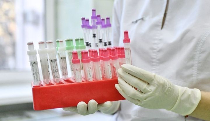 За сутки в ЛНР выявили более 80 случаев заражения коронавирусом